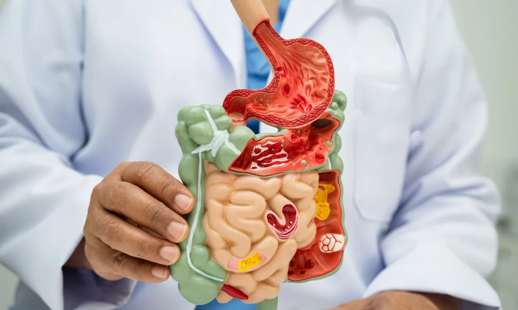 nutrigenomics gastrointestinal health